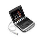 Chison SonoBook 9