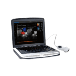 Chison SonoBook 9